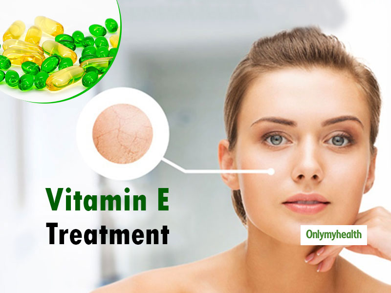 Sikn Care Vitamin-E Capsule
