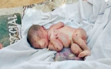 निजी अस्पताल से दो दिन के नवजात को उठा ले गया कुत्ता , नोंच-नोंच कर मार डाला