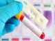 हरियाणा में पिछले 5 सालों में तेजी से बढ़े HIV के मामले,