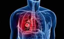 सर्दियों में प्रदूषण का स्तर भी बढ़ जाता है !