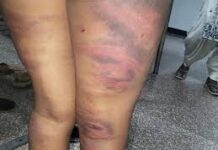 हरियाणा:मौलवी की करतूत सुन खौल उठेगा खून,9 साल के बच्चे को रस्सी से बांधा, 4 घंटे बरसाता रहा डंडे! 9 साल के बेटे ने परिवार वालों को बताया कि वह रविवार को तालीम लेने मस्जिद नहीं गया था।
