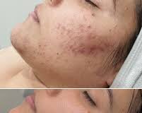 चेहरा चमकाने के लिए लोग ना जाने क्या-क्या करते हैं। मगर आपको अपनी स्किन का ख्याल रखने के लिए कुछ गलत आदतों को छोड़ने की जरूरत है।