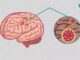 Hidden Dementia Sign: दिमाग की गंभीर बीमारी है डिमेंशिया, पैरों से होती है शुरू, खुद डॉक्टर ने बताया लक्षण बात भूल जाना एक आम स्थिति है। लेकिन यह डिमेंशिया जैसी गंभीर समस्या की शुरुआत हो सकती है।