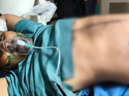 पुलिस टीम ने बदमाशों को घेरने की कोशिश की, जिसके दौरान दोनों पक्षों से ताबड़तोड़ फायरिंग हुई।