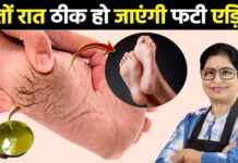 इसके लिए आपको सरसों के तेल की जरूरत होगी। आइए इस नुस्खे के बारे में विस्तार से जान लेते हैं।