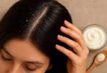 डैंड्रफ की समस्या से बचने के लिए हम आमतौर पर तरह-तरह के शैंपू और कंडीशनर लगाते हैं।