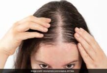 क्या रोजमेरी का तेल बालों की वृद्धि बढ़ाता है? त्वचा विशेषज्ञ चांदनी गुप्ता ने देसी नुस्खों की सच्चाई बताई। बालों का झड़ना कम करने और इन्हें मजबूत बनाने के लिए अक्सर लोग रोजमेरी ऑयल की मदद लेते हैं।