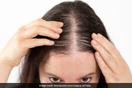 बालों का झड़ना कम करने और इन्हें मजबूत बनाने के लिए अक्सर लोग रोजमेरी ऑयल की मदद लेते हैं।