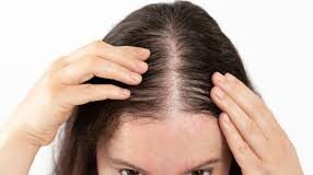 क्या रोजमेरी का तेल बालों की वृद्धि बढ़ाता है? त्वचा विशेषज्ञ चांदनी गुप्ता ने देसी नुस्खों की सच्चाई बताई। बालों का झड़ना कम करने और इन्हें मजबूत बनाने के लिए अक्सर लोग रोजमेरी ऑयल की मदद लेते हैं।