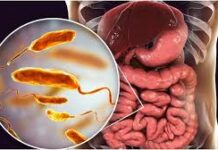 चिंता, तनाव, घबराहट बढ़ रही है? खाने की गलत आदत हो सकती है वजह, डॉक्टर से जानें दिमाग और पेट का कनेक्शन आज की भागदौड़ भरी जिंदगी में तला-भुना और प्रोसेस्ड फूड लोगों की डेली डाइट का हिस्सा बन चुका है।