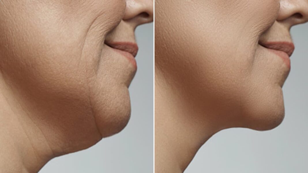 अगर अपने एजिंग प्रोसेस को हेल्दी रखना चाहते हैं तो डॉक्टर की बताई इन गलत आदतों को पहचानकर आज ही छोड़ दें। अगर अपने एजिंग प्रोसेस को हेल्दी रखना चाहते हैं तो डॉक्टर की बताई इन गलत आदतों को पहचानकर आज ही छोड़ दें।