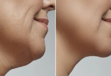 अगर अपने एजिंग प्रोसेस को हेल्दी रखना चाहते हैं तो डॉक्टर की बताई इन गलत आदतों को पहचानकर आज ही छोड़ दें।