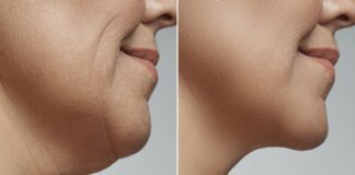 सेडेंट्री लाइफस्टाइल से जल्दी आता है बुढ़ापा, ऐसी 7 आदतों को पहचानकर तुरंत कर देना चाहिए बंद अगर अपने एजिंग प्रोसेस को हेल्दी रखना चाहते हैं तो डॉक्टर की बताई इन गलत आदतों को पहचानकर आज ही छोड़ दें।