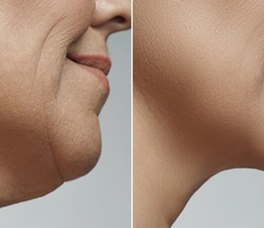 अगर अपने एजिंग प्रोसेस को हेल्दी रखना चाहते हैं तो डॉक्टर की बताई इन गलत आदतों को पहचानकर आज ही छोड़ दें।