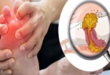 प्यूरीन से भरे फूड खाने पर यूरिक एसिड का लेवल बढ़ता है।